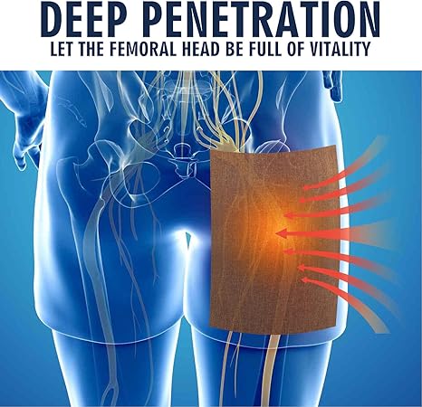 اختراق عميق — Deep Penetration للعصب الوركي